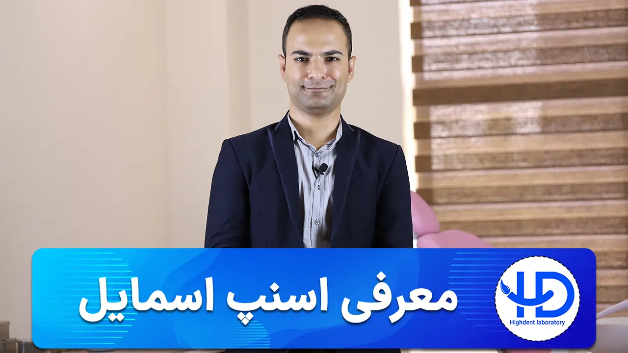 لمینت متحرک یا اسنپ اسمایل چیست