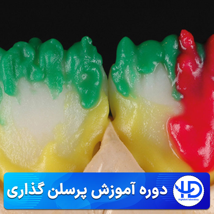 دوره آموزش پرسلن گذاری