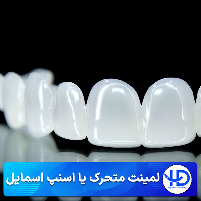 اسنپ اسمایل یا لمینت متحرک