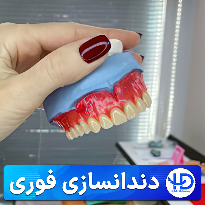 دندانسازی فوری (های دنت)