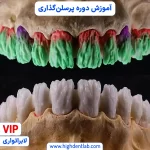 آموزش پودر گذاری دندانسازی