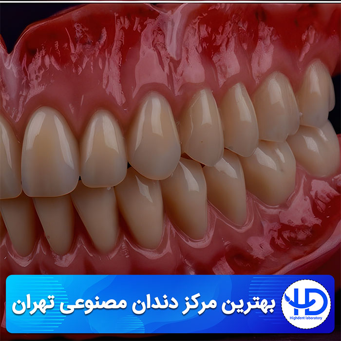 معرفی بهترین مرکز دندان مصنوعی تهران