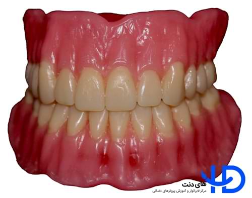 دندان مصنوعی ژاپنی یاماهاچی