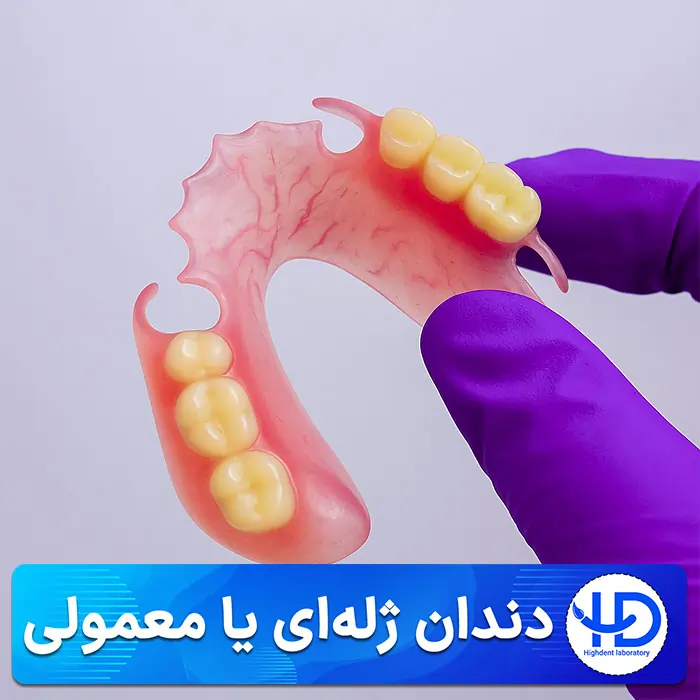 دندان مصنوعی ژله ای بهتر است یا معمولی