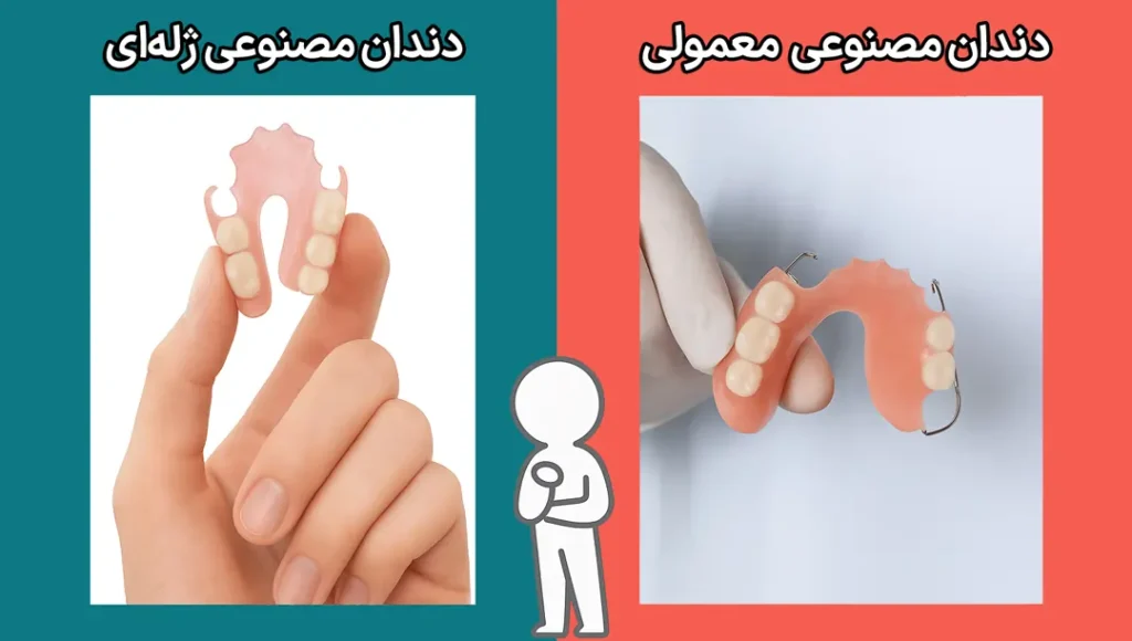 دندان مصنوعی ژله ای با معمولی
