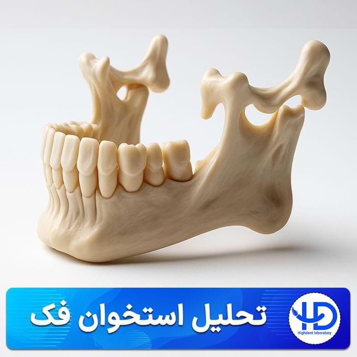 تحلیل استخوان فک