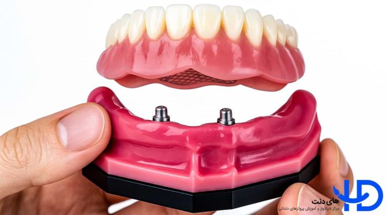 قیمت اوردنچر فک بالا و پایین