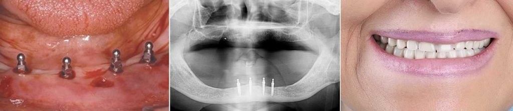 مزیت انواع اوردنچر