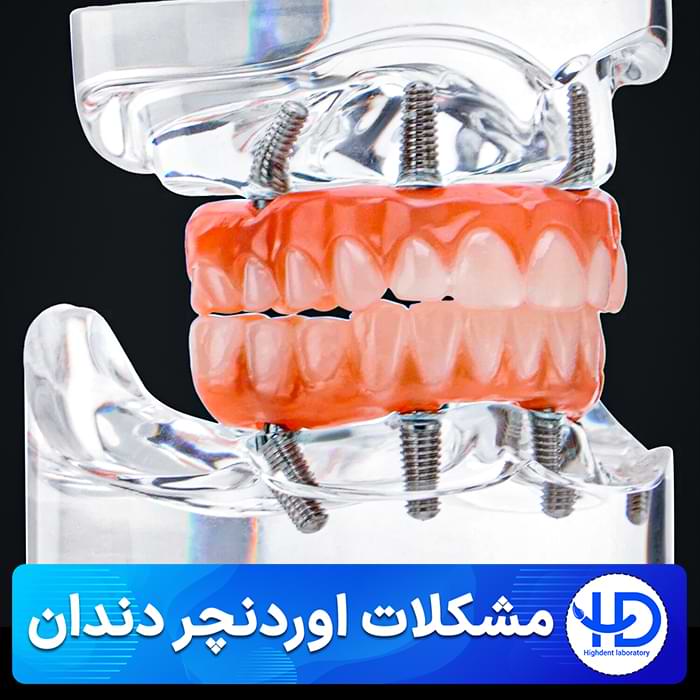 معایب و مشکلات اوردنچر دندان