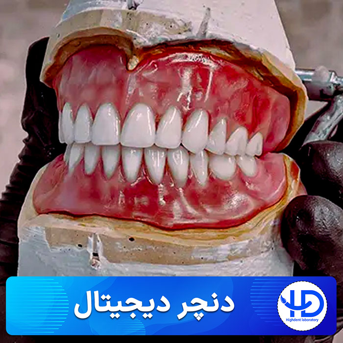 دندان مصنوعی دیجیتال