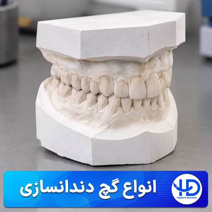 انواع گچ دندانسازی