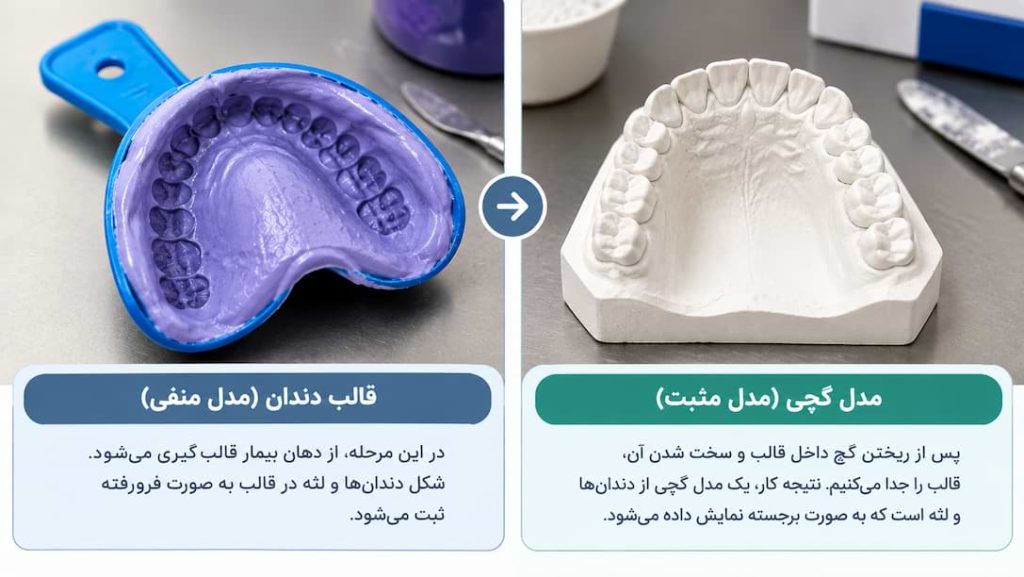 تفاوت قالب دندان و مدل گچی